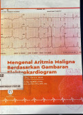 Mengenal aritmia maligna berdasarkan gambaran elektrokardiogram: seri kardiologi bagi dokter umum